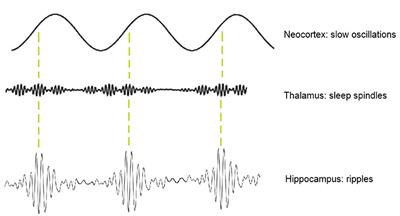 Physiological Ripples Associated With Sleep Spindles Can Be Identified in Patients With Refractory Epilepsy Beyond Mesio-Temporal Structures